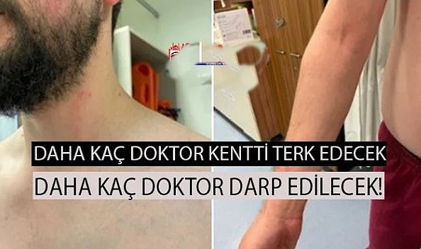 Şanlıurfa'da Uzman doktor saldırıya uğradı!