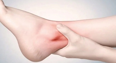 Vücutta Oluşan Ödeme Dikkat!