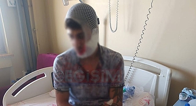 Urfa'da önce motorsikletini çaldılar, sonra satırla dövdüler