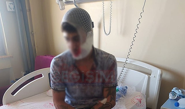 Urfa'da önce motorsikletini çaldılar, sonra satırla dövdüler